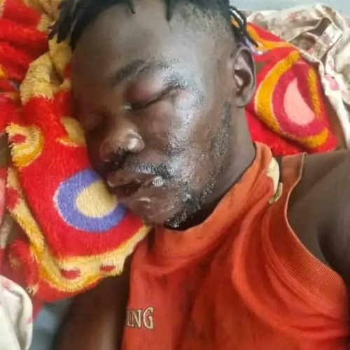 Cameroun/ De l’aide pour sauver un étudiant tchadien victime d’un accident